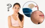 Descubra se Whey protein causa acne e outros 3 fatos que você não sabia sobre o suplemento