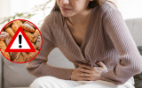 Aposto que você come: esses são os 3 PIORES ALIMENTOS para o intestino, segundo especialista