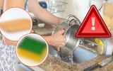 Esses 7 objetos de cozinha são os maiores acumuladores de fungos e bactérias que podem agredir a saúde