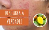 Manga causa acne? Faz mal comer à noite? Nutricionista tira todas as dúvidas sobre a fruta!