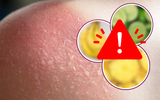 CUIDADO: essas 6 frutas são um perigo para a sua pele e você deve ter muito cuidado na hora de comer e manusear!
