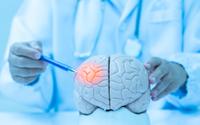 Sou neurologista e garanto: os riscos de Alzheimer aumentam quando você faz isso