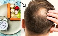 Com medo de ficar calvo? Dieta queridinha da internet pode aumentar as chances disso acontecer, segundo novo estudo