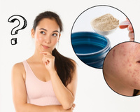 Descubra se Whey protein causa acne e outros 3 fatos que você não sabia sobre o suplemento