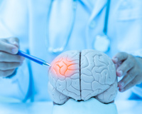 Sou neurologista e garanto: os riscos de Alzheimer aumentam quando você faz isso