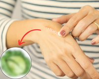 Esse alimento barato é ótimo para a qualidade da sua pele e traz vigor após cirurgias