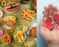 Seus rins não se regeneram: médico aponta 5 tipos de alimentos que você deve evitar (e o que comer para mantê-los saudáveis)