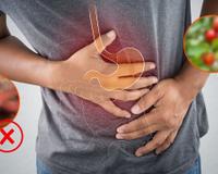 Atenção! Esses são os alimentos que você deve evitar se sofre de gastrite, eles podem estar piorando a situação