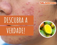 Manga causa acne? Faz mal comer à noite? Nutricionista tira todas as dúvidas sobre a fruta!