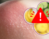 CUIDADO: essas 6 frutas são um perigo para a sua pele e você deve ter muito cuidado na hora de comer e manusear!