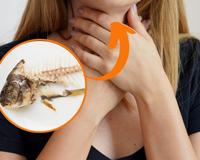 É isso que você deve fazer se ficar engasgado com uma espinha de peixe