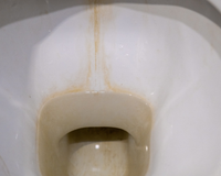 Nem sal, nem bicarbonato de sódio: essa é a melhor mistura caseira para remover o calcário do vaso sanitário e deixá-lo mais branco do que nunca