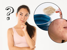 Descubra se Whey protein causa acne e outros 3 fatos que você não sabia sobre o suplemento