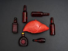 Não é só álcool: saiba quais são as bebidas mais prejudiciais para quem tem gordura no fígado