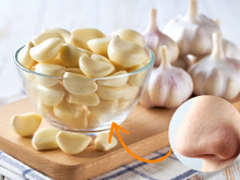 Que trend maluca é essa de alho no nariz? Entenda os perigos dessa nova tendência