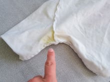 TudoGostoso ensina como remover manchas de desodorante das axilas das camisas, facilitando a lavagem das manchas amarelas