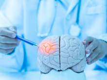 Sou neurologista e garanto: os riscos de Alzheimer aumentam quando você faz isso