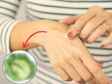 Esse alimento barato é ótimo para a qualidade da sua pele e traz vigor após cirurgias