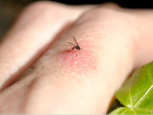 Com as chuvas e o calor, é normal ter mosquitos em casa se você não tem essas plantas para afastá-los naturalmente