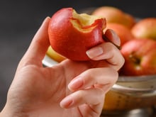 5 coisas que acontecem com o corpo se você comer uma maçã por dia todos os dias?