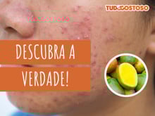 Manga causa acne? Faz mal comer à noite? Nutricionista tira todas as dúvidas sobre a fruta!
