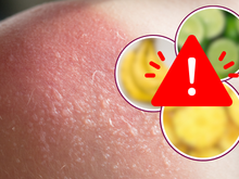 CUIDADO: essas 6 frutas são um perigo para a sua pele e você deve ter muito cuidado na hora de comer e manusear!