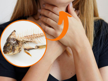 É isso que você deve fazer se ficar engasgado com uma espinha de peixe