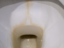 Nem sal, nem bicarbonato de sódio: essa é a melhor mistura caseira para remover o calcário do vaso sanitário e deixá-lo mais branco do que nunca