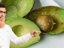 Popular nutricionista adverte sobre o abacate: "É uma gordura maravilhosa, mas..."