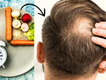 Com medo de ficar calvo? Dieta queridinha da internet pode aumentar as chances disso acontecer, segundo novo estudo