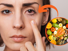 Pra te ver melhor: alimentação interfere na visão e esse oftalmologista indica o que comer