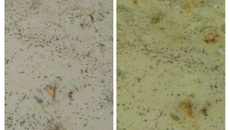 Torta de salsicha tipo viena