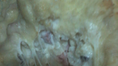 Couve-flor recheada e gratinada