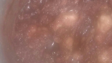 Doce de banana simples