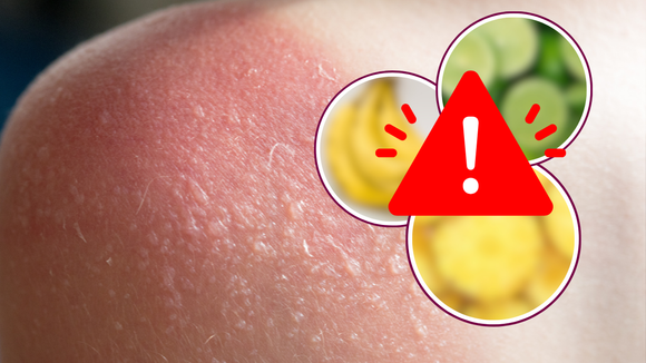 CUIDADO: essas 6 frutas são um perigo para a sua pele e você deve ter muito cuidado na hora de comer e manusear!