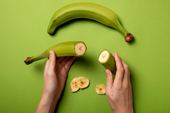 William Arias, especialista em saúde: "Comer bananas verdes pode reduzir as chances de contrair câncer colorretal"