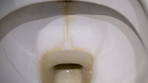 Aquela camada escura no fundo da louça tem explicação e também tem solução barata. (Foto: Shutterstock)