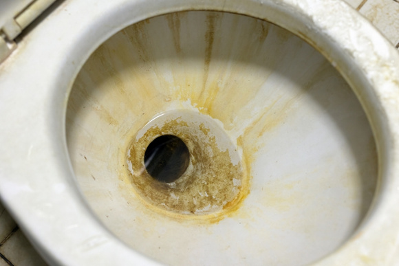 Como limpar manchas difíceis no vaso sanitário? Aqui estão alguns métodos caseiros que você pode usar