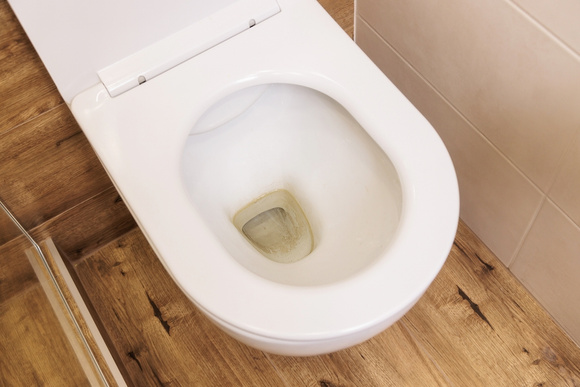 Já não sabia mais o que fazer para tirar as manchas do vaso sanitário até que aprendi esse truque muito simples