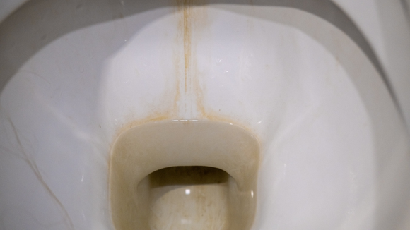 Nem sal, nem bicarbonato de sódio: essa é a melhor mistura caseira para remover o calcário do vaso sanitário e deixá-lo mais branco do que nunca