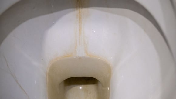 Regiões onde a água é mais dura podem sofrer mais com o acúmulo de calcários em certos locais (Créditos: Shutterstock)