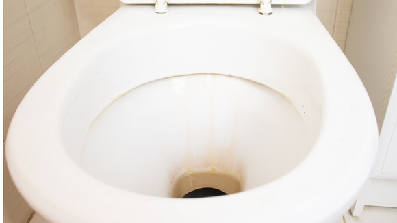 Isso pode ajudar na limpeza enquanto você dorme. (Créditos: Canva)