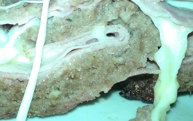 Rocambole de carne moída com queijo e presunto