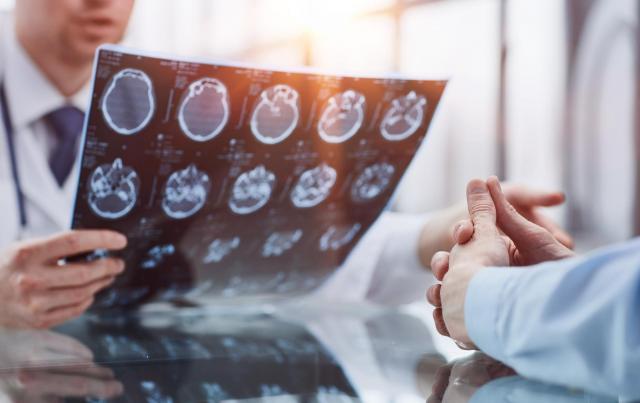 Cientistas acabam de descobrir um grande problema com as recomendações de vitamina B12 - e seu cérebro pode estar em risco