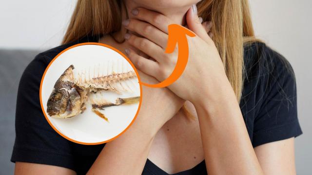 É isso que você deve fazer se ficar engasgado com uma espinha de peixe