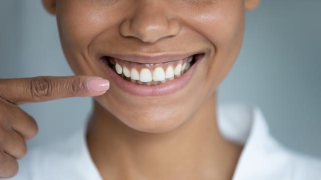 Esses alimentos que você tem em casa vão deixar os seus dentes mais bonitos