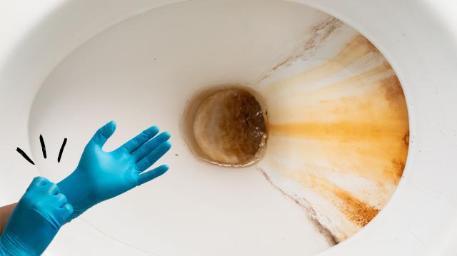 Como se livrar definitivamente das manchas no vaso sanitário: aqui está o guia de uma profissional de limpeza