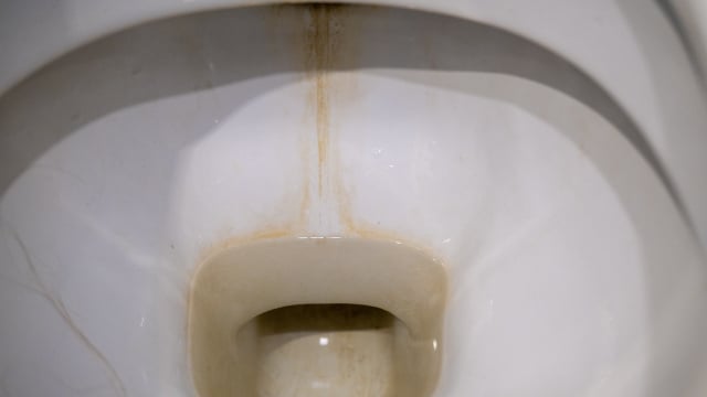 Aquela camada escura no fundo da louça tem explicação e também tem solução barata. (Foto: Shutterstock)