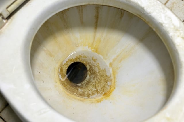 Como limpar manchas difíceis no vaso sanitário? Aqui estão alguns métodos caseiros que você pode usar