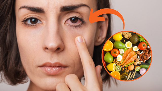 Pra te ver melhor: alimentação interfere na visão e esse oftalmologista indica o que comer